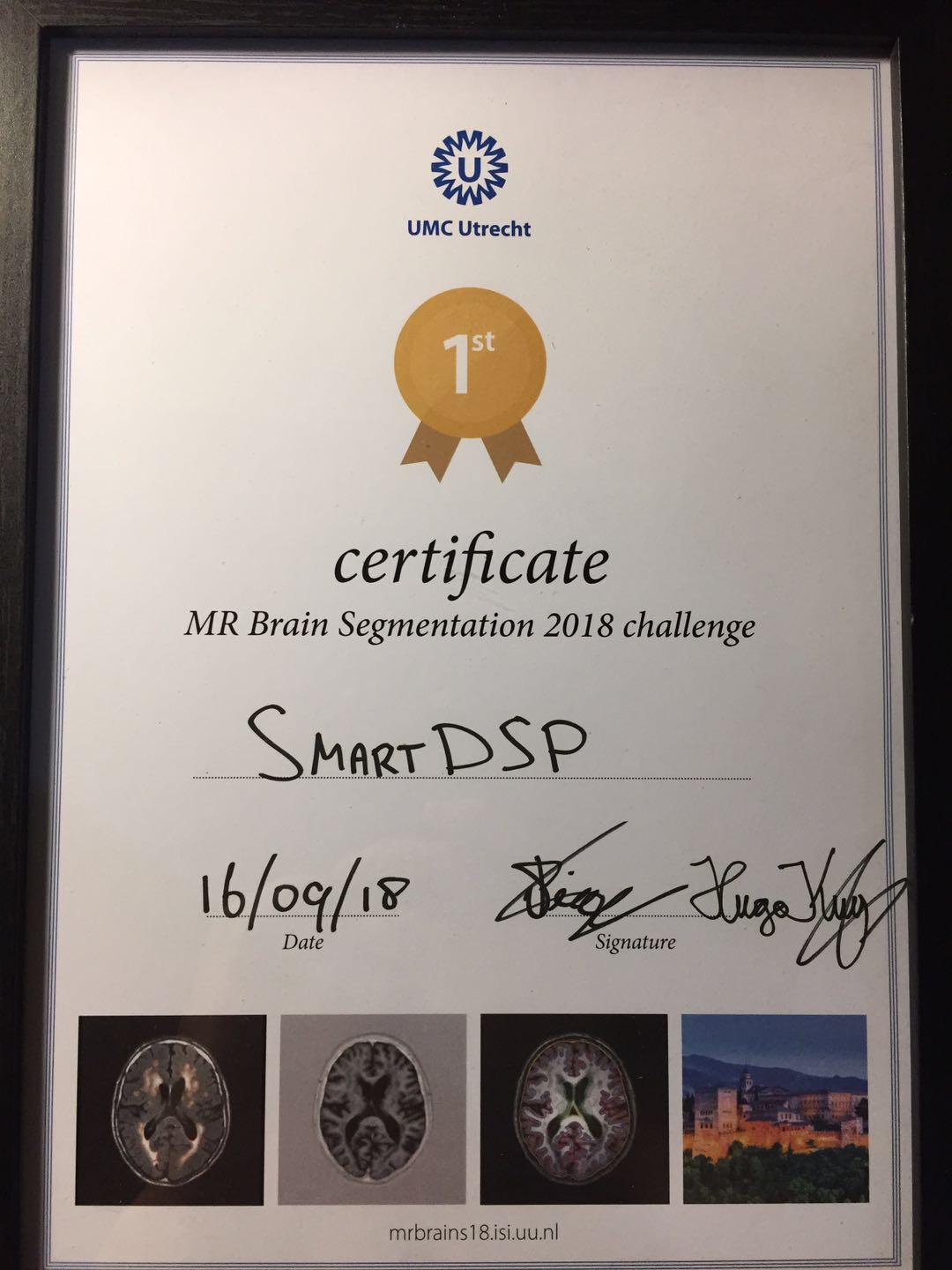 牛！实验室SmartDSP团队获得MRBrainS18竞赛三分类分割项目冠军